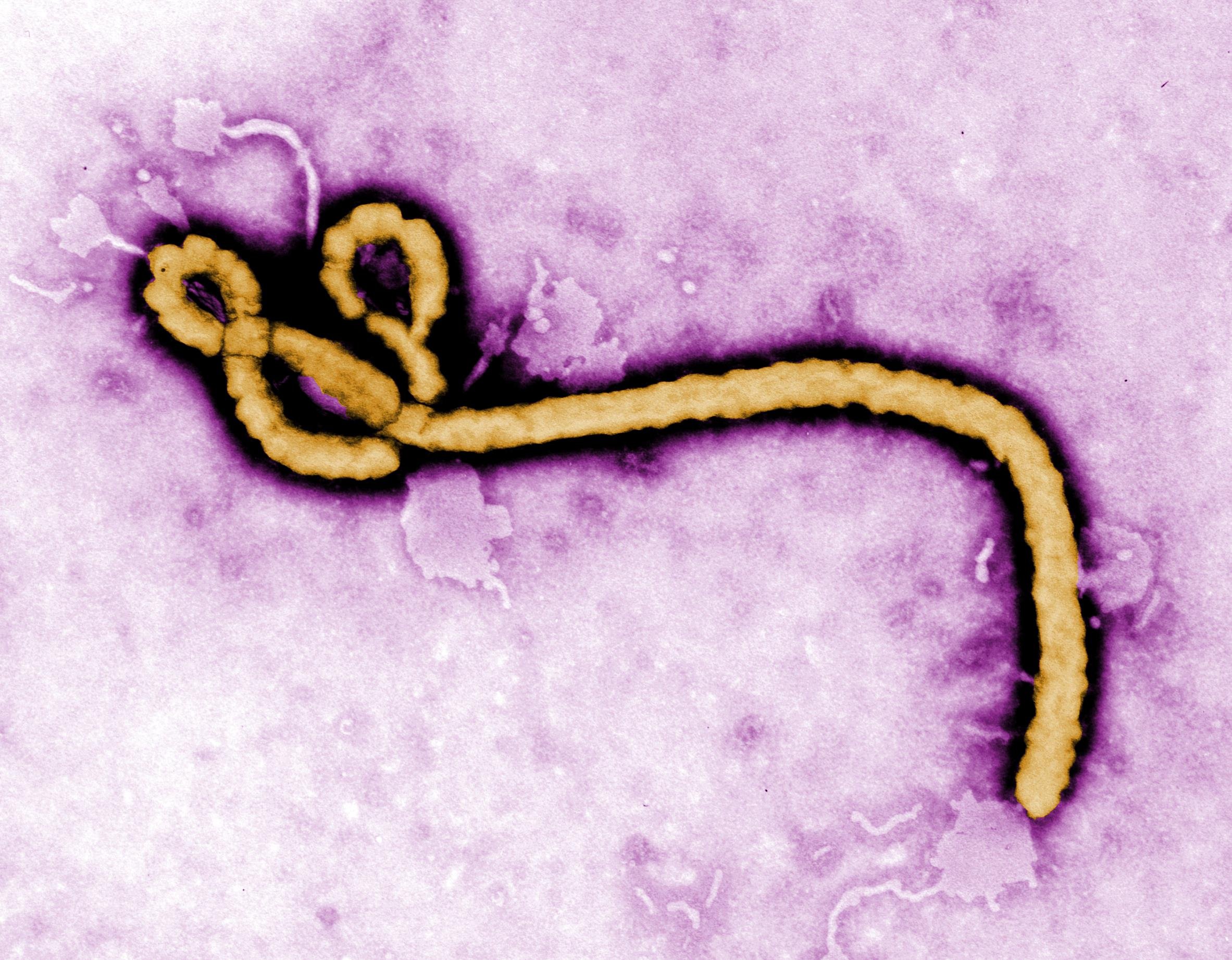 Zaire ebolavirus. Фото: Вікіпедія