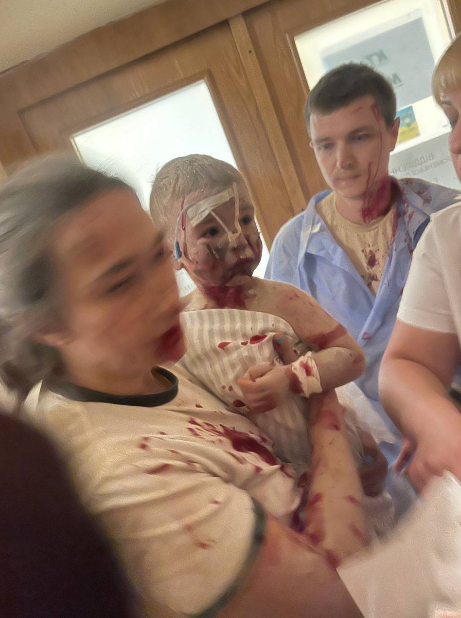 Consequences of the attack on the Ohmatdyt children's hospital. Photos: social networks