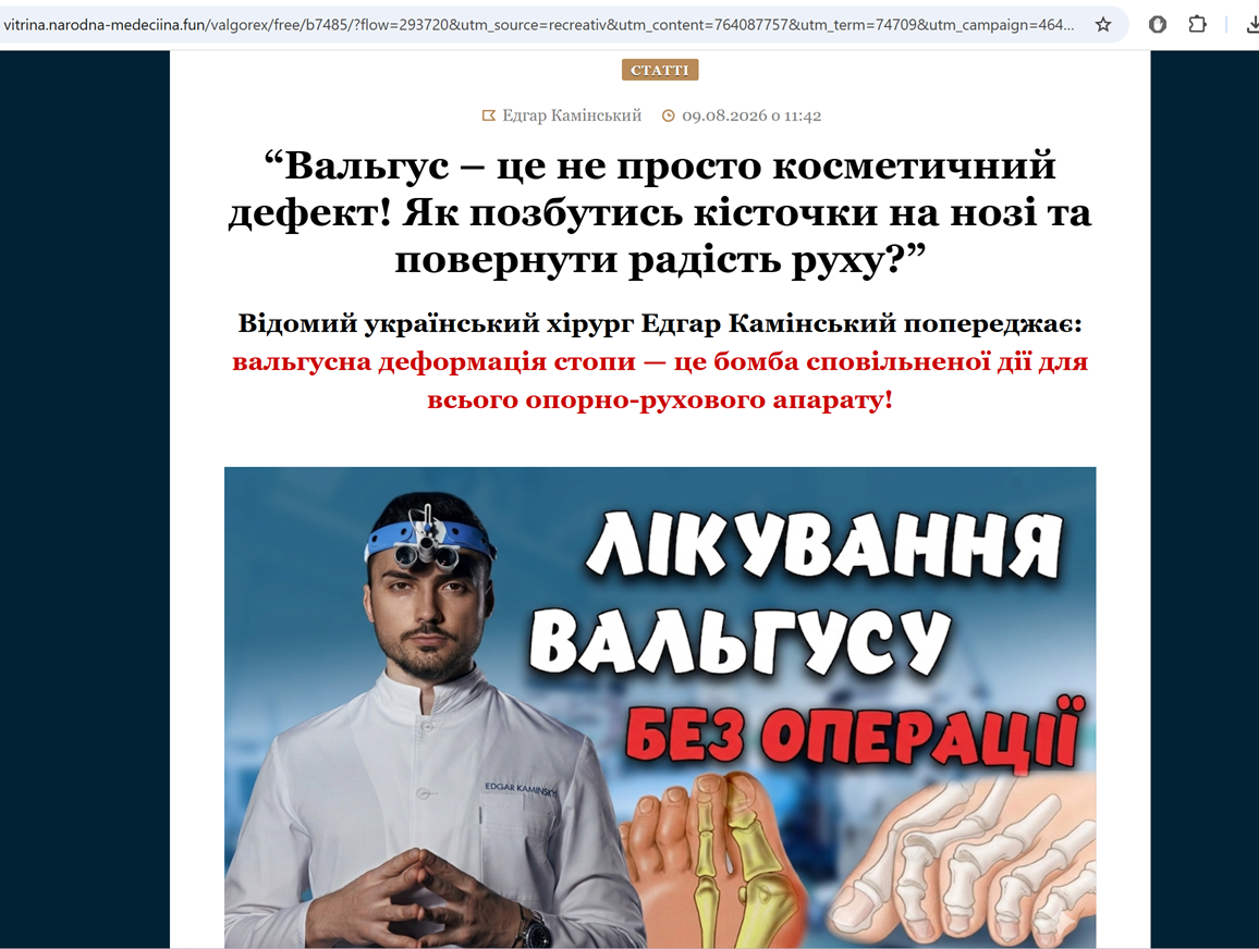 Куди веде реклама з сайту Гордон
