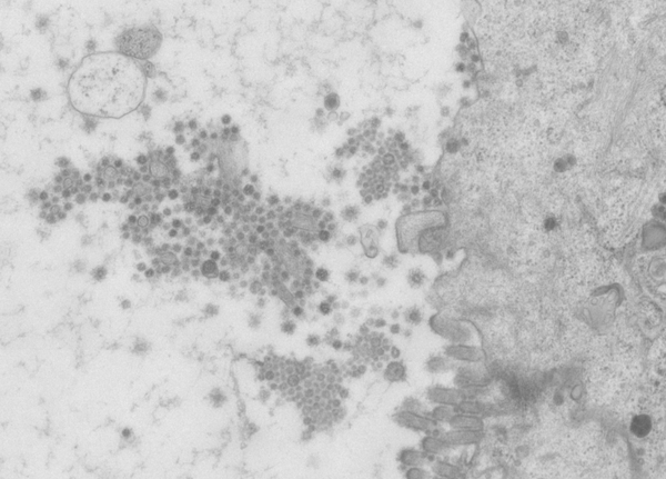 Як коронавіруси інфікують клітини? Найдетальніші інтерактивні фото
