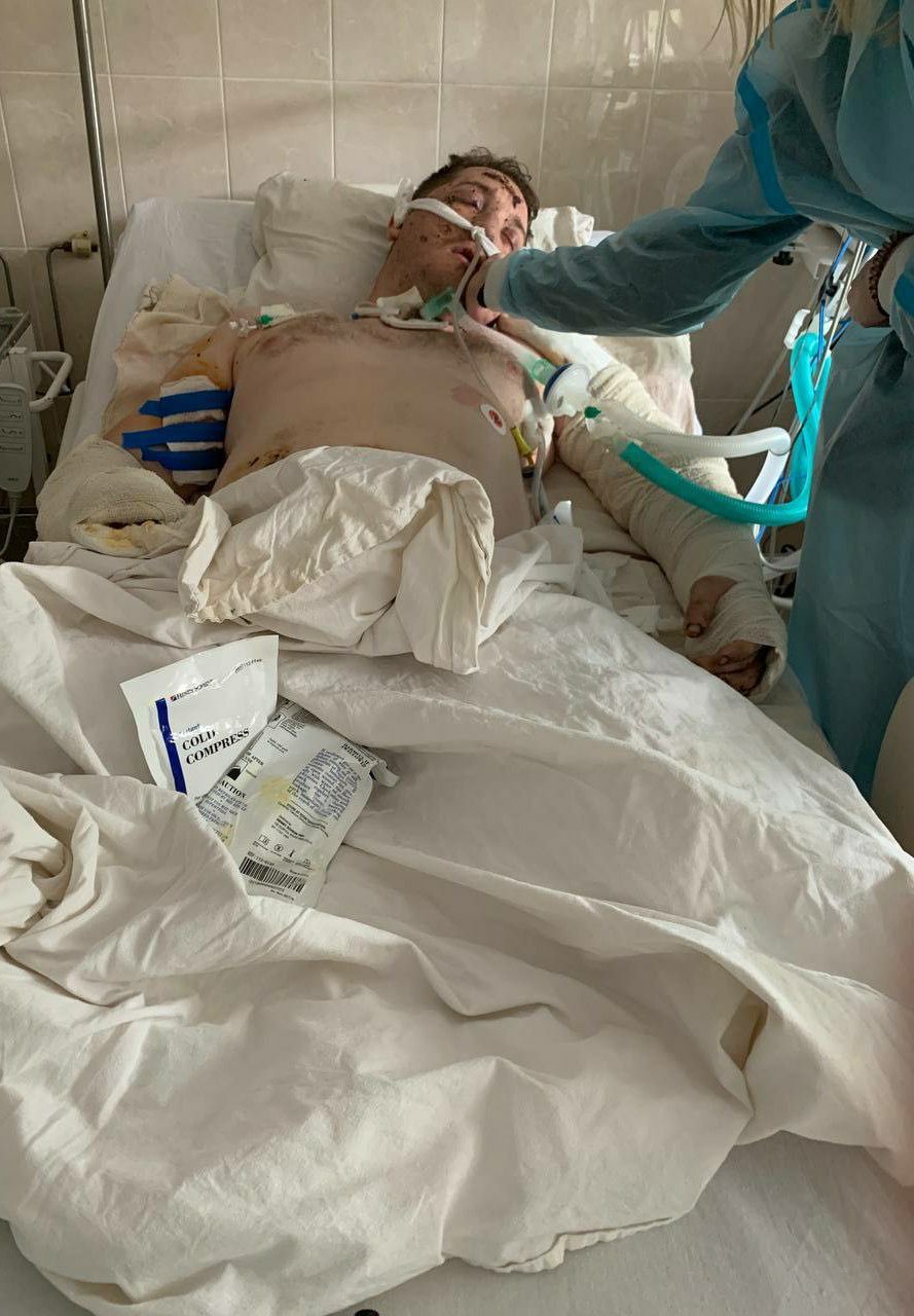 Олег Симороз після поранення. Фото з його твіттер-сторінки