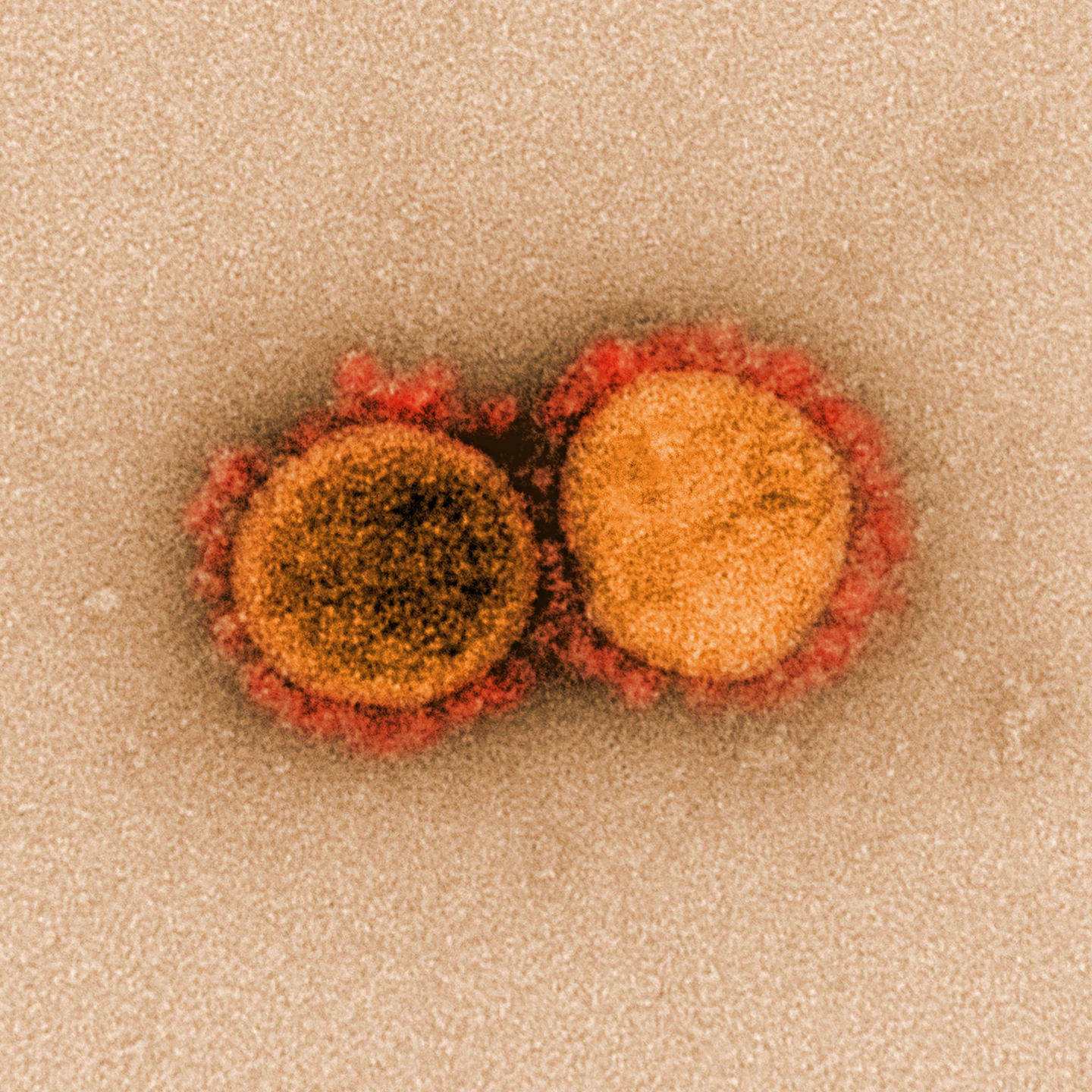 Мікрографія передачі вірусу SARS-CoV-2