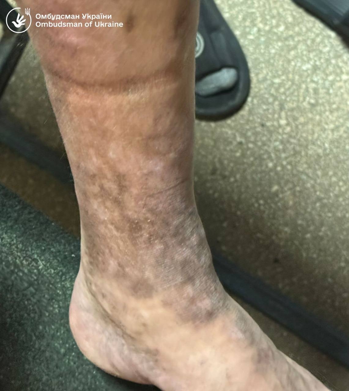 ужгород тцк